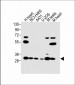 VDAC3 Antibody (Center)